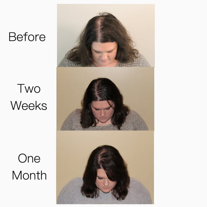 Elleada Vegan Hair Strengthening Serum – Natural Relief for Hair Loss & Itchy Scalp