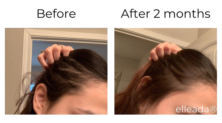 Elleada Vegan Hair Strengthening Serum – Natural Relief for Hair Loss & Itchy Scalp