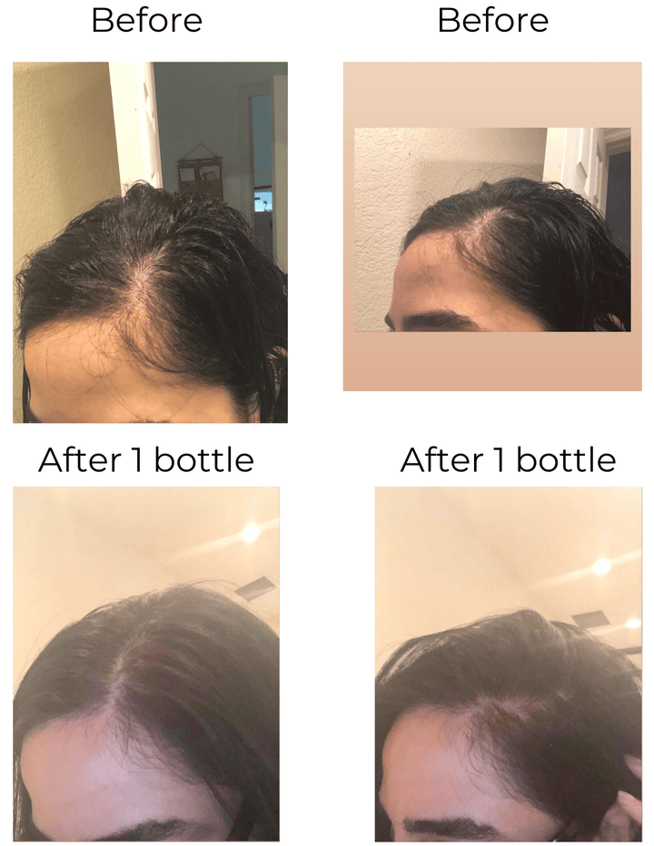 Elleada Vegan Hair Strengthening Serum – Natural Relief for Hair Loss & Itchy Scalp