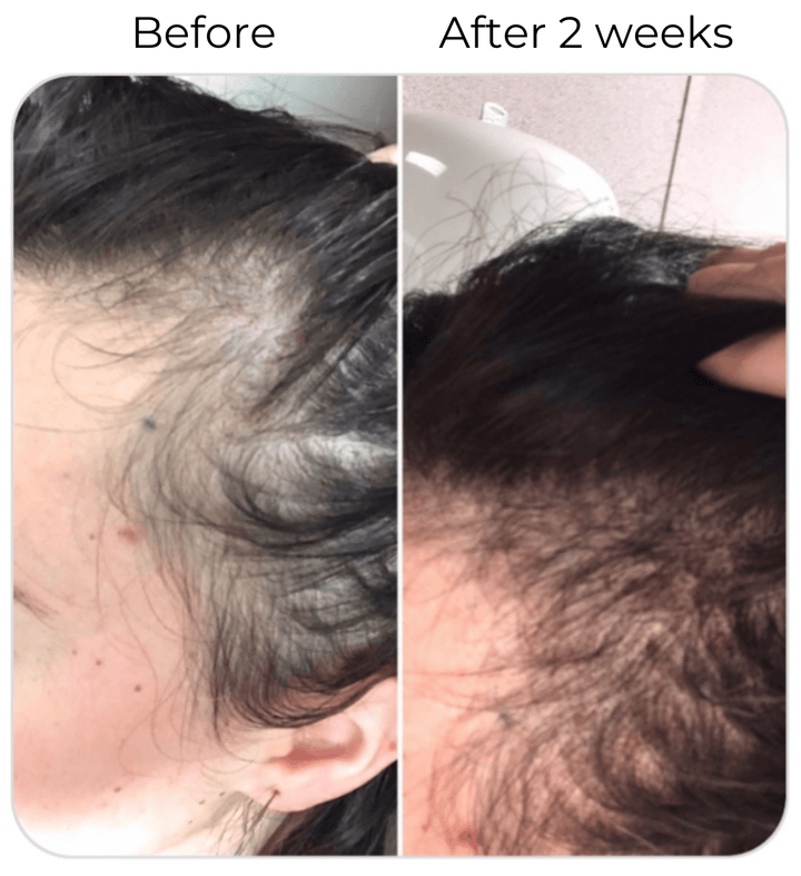 Elleada Vegan Hair Strengthening Serum – Natural Relief for Hair Loss & Itchy Scalp