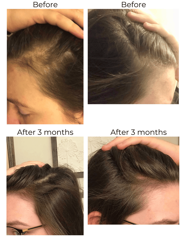 Elleada Vegan Hair Strengthening Serum – Natural Relief for Hair Loss & Itchy Scalp