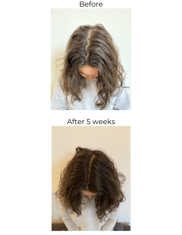 Elleada Vegan Hair Strengthening Serum – Natural Relief for Hair Loss & Itchy Scalp