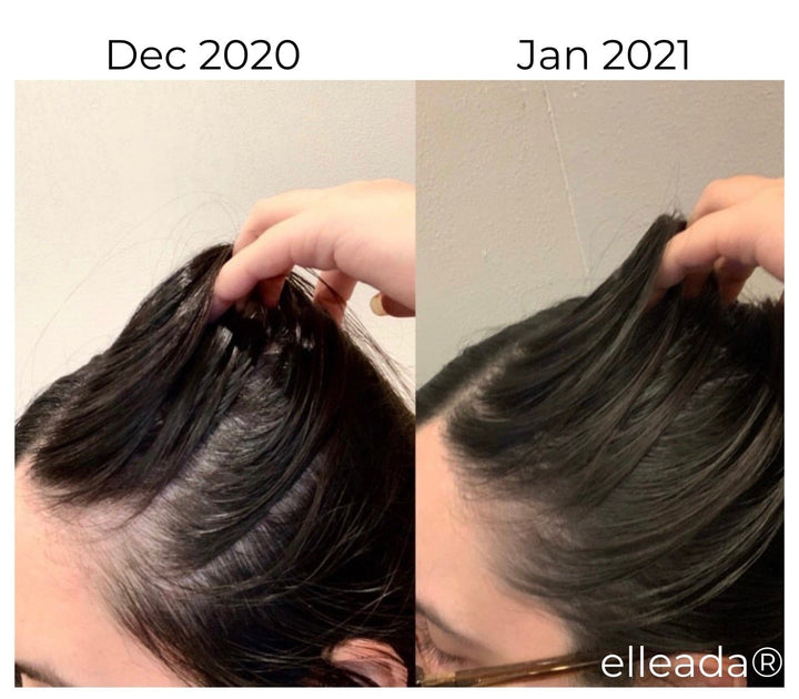 Elleada Vegan Hair Strengthening Serum – Natural Relief for Hair Loss & Itchy Scalp