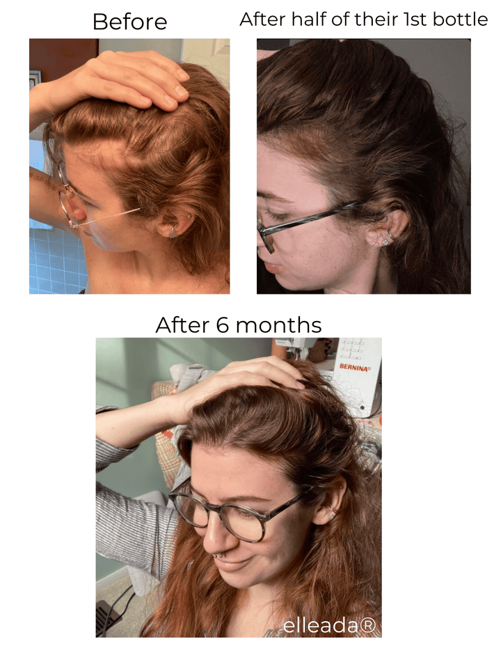 Elleada Vegan Hair Strengthening Serum – Natural Relief for Hair Loss & Itchy Scalp