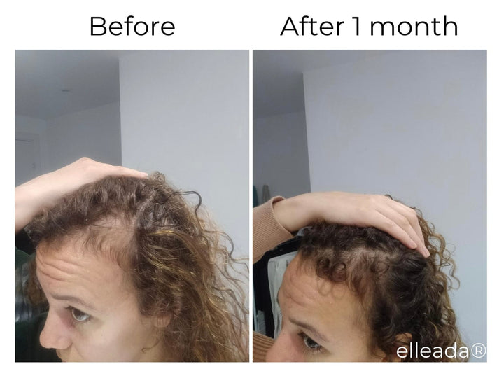 Elleada Vegan Hair Strengthening Serum – Natural Relief for Hair Loss & Itchy Scalp