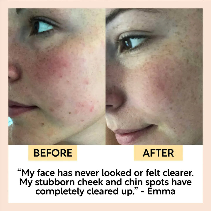 UpCircle Cinnamon + Ginger Cleansing Bar