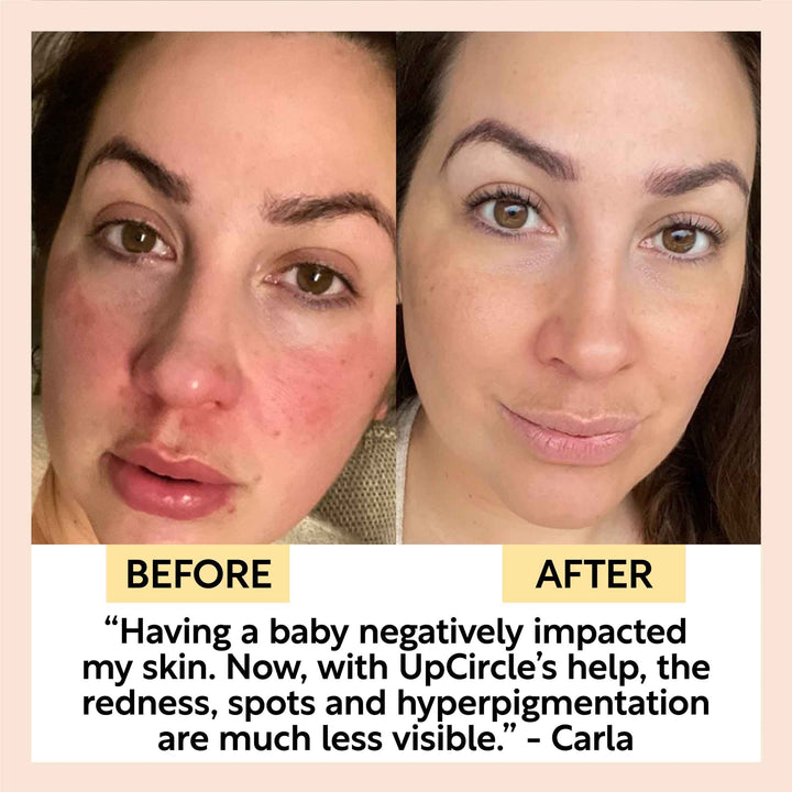 UpCircle Day + Night Hydration Set