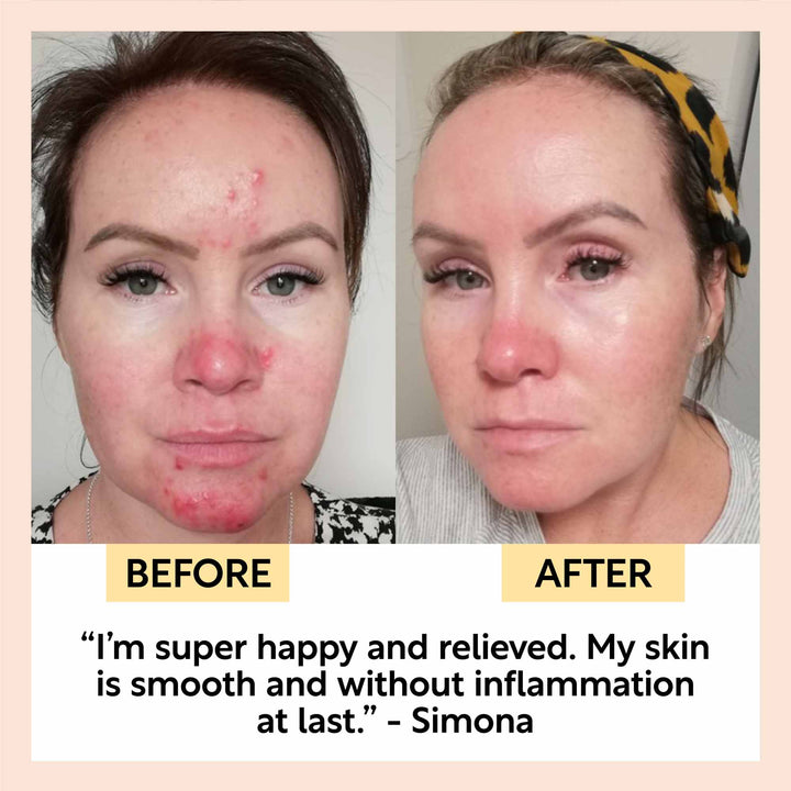 UpCircle Day + Night Hydration Set