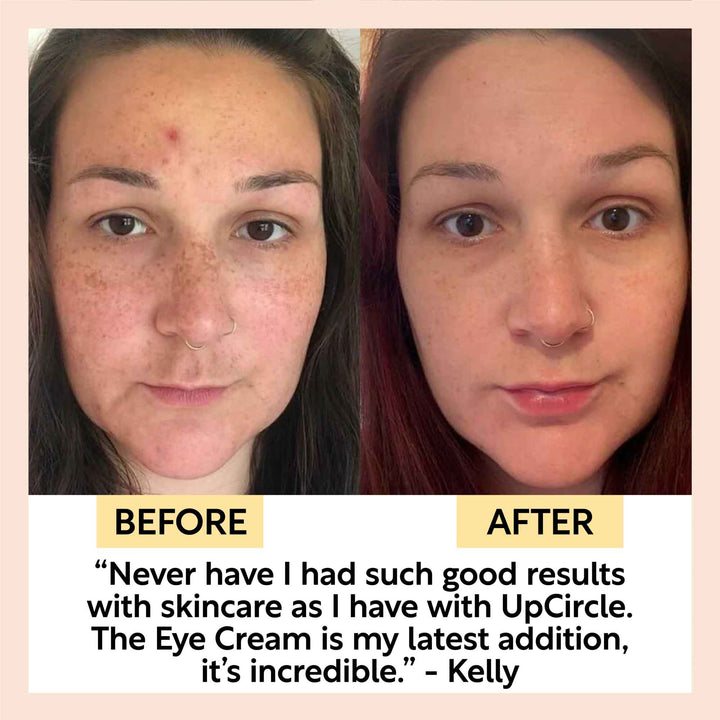 UpCircle Eye Cream