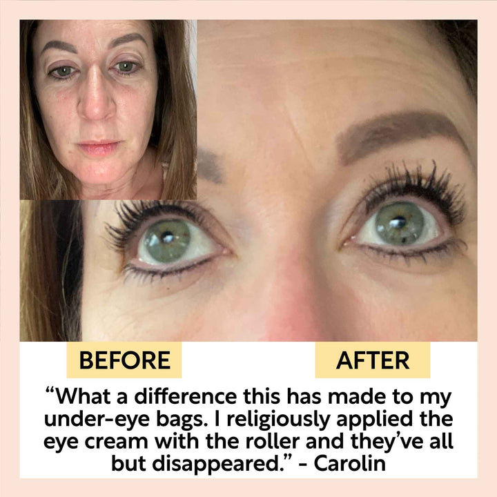 UpCircle Eye Cream