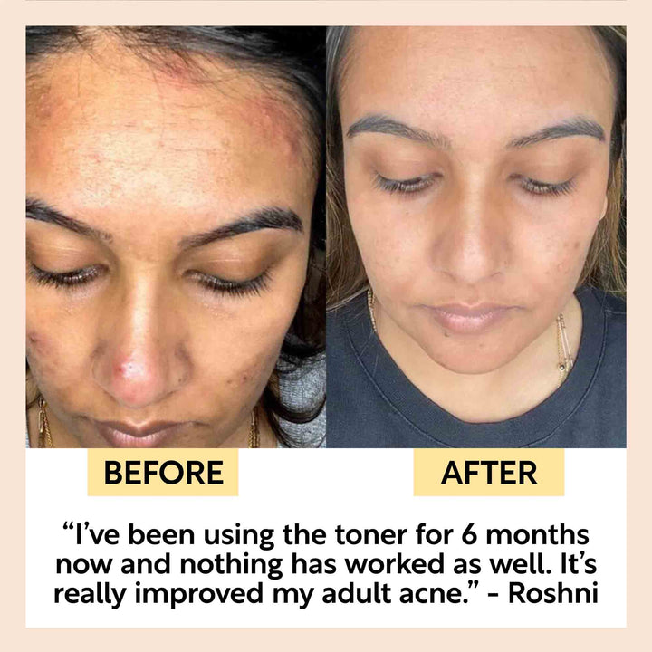 UpCircle Face Toner