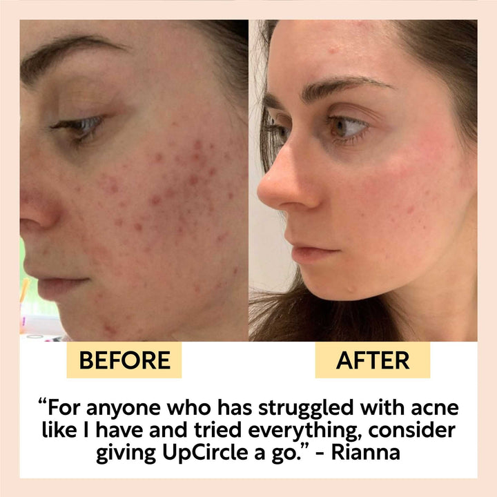 UpCircle Face Toner