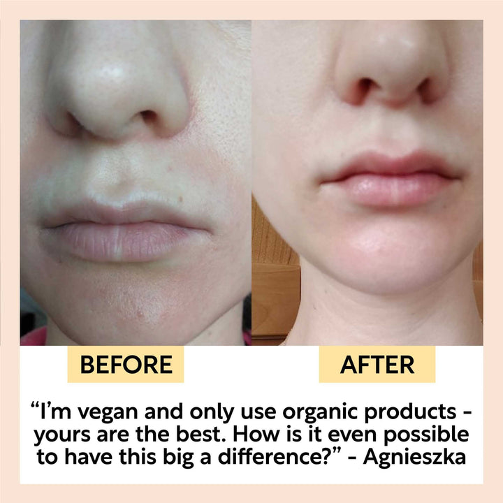 UpCircle Hydrating Face Oil with Coffee Extract